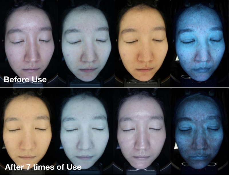 Clinical facial imaging comparing skin age indicators before use and after seven applications of a hydrogel mask