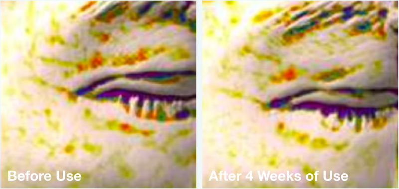 Clinical before-and-after microscopy images showing improved wrinkle appearance and dermal skin structure after four weeks of Roller Gold use