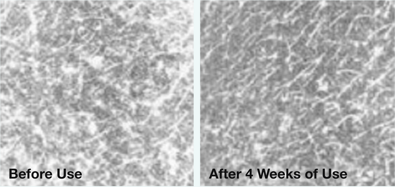 Clinical before-and-after microscopy images showing improved skin hydration after four weeks of Roller Gold use